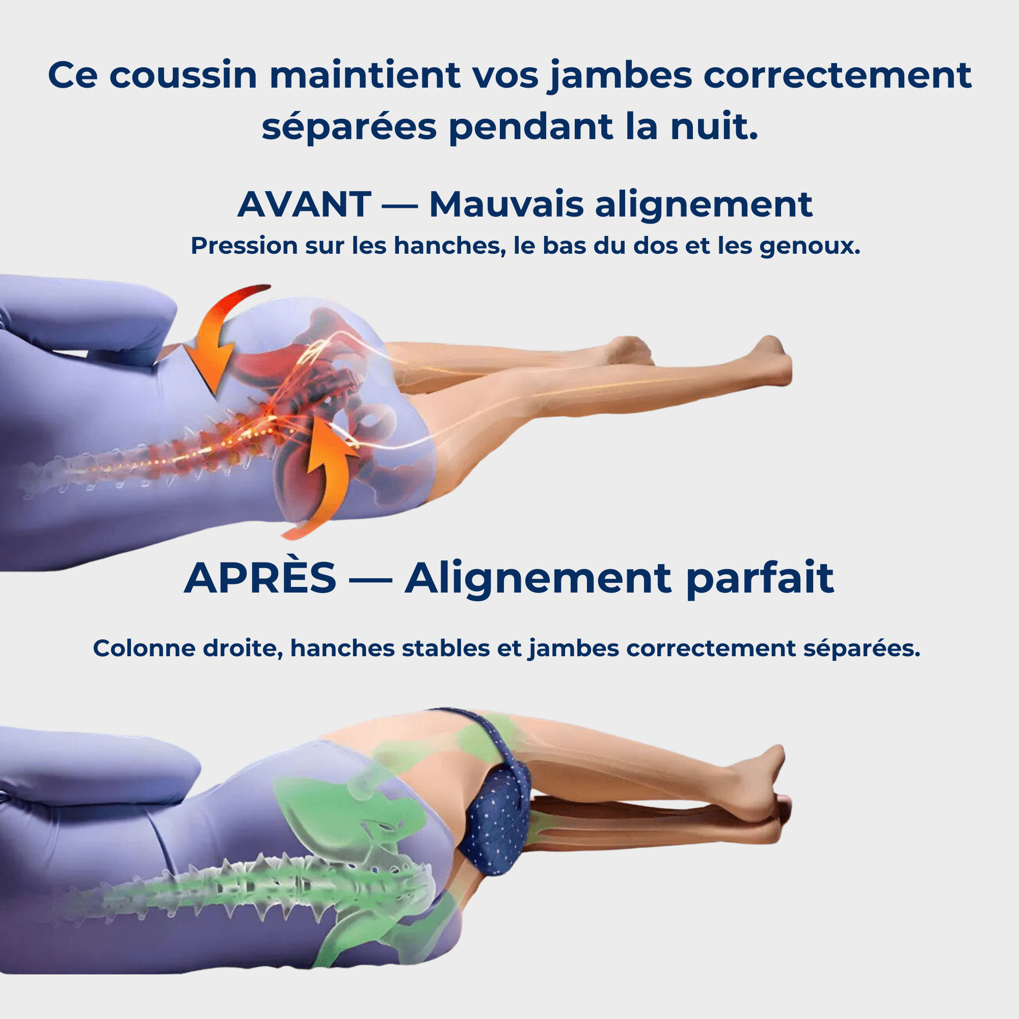 OLYLO LegEase™ — Coussin Orthopédique Genoux & Jambes